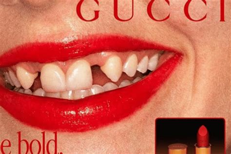 Human teeth: In light of new Gucci lipstick ad, here's what